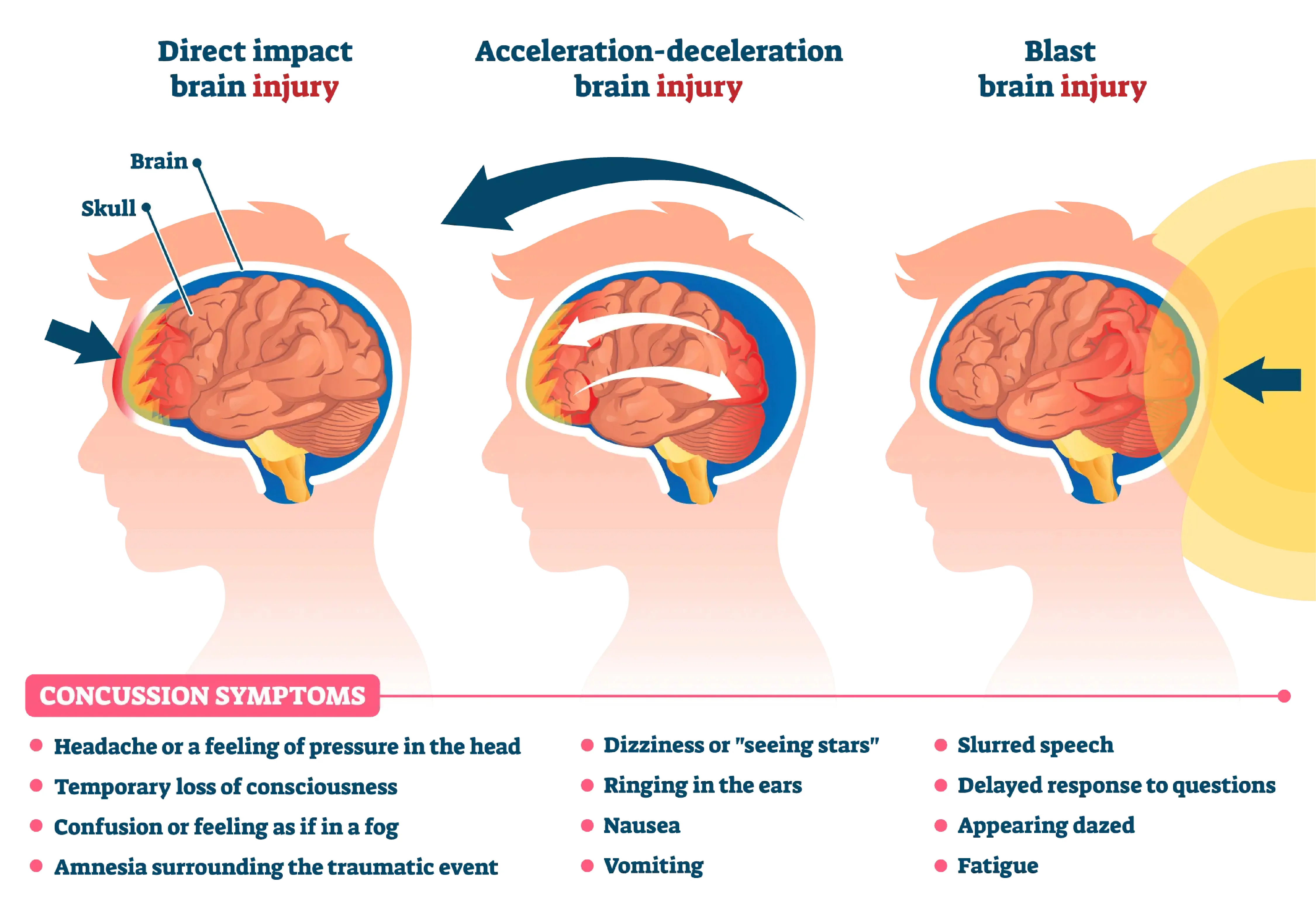 Head Injury & Brain Trauma Care.webp